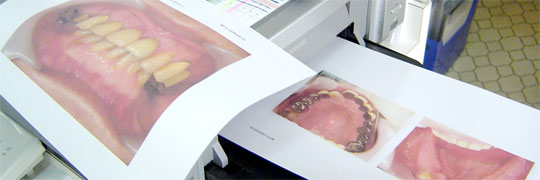 口腔内画像の印刷